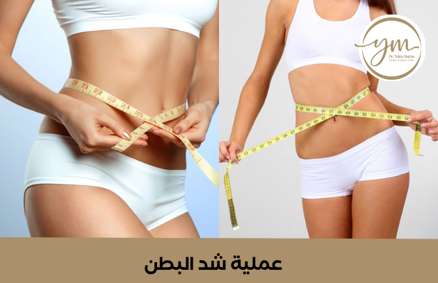 اسعار عملية شد البطن