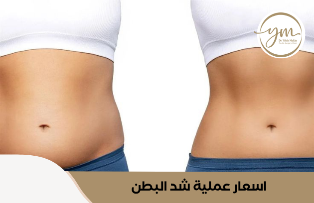 اسعار عملية شد البطن