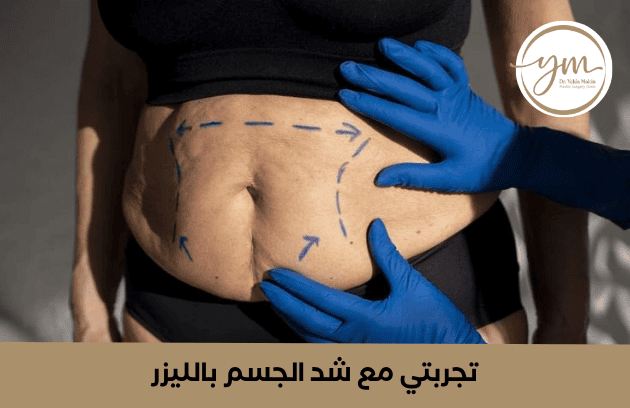 تجربتي مع شد الجسم بالليزر