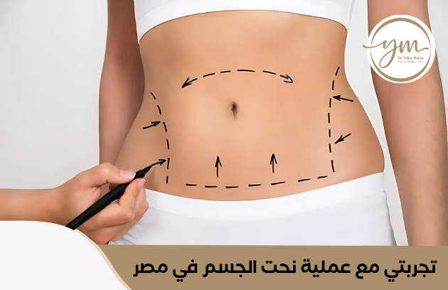 تجربتي مع عملية نحت الجسم في مصر