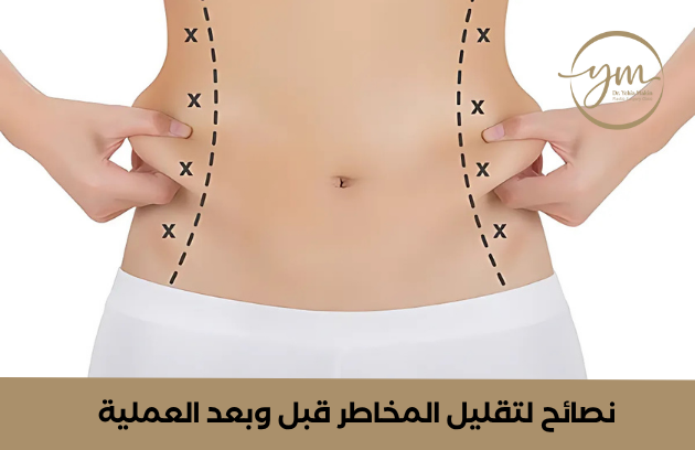 مخاطر عمليات نحت الجسم