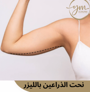 نحت الذراعين بالليزر