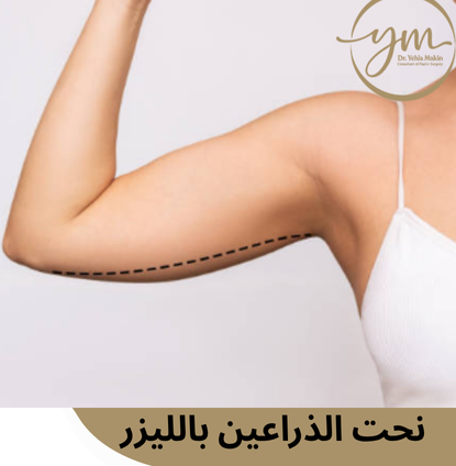 نحت الذراعين بالليزر