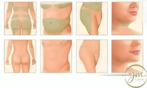 كم تستغرق عملية نحت الجسم