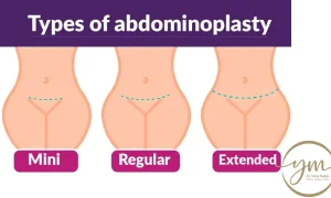 الفرق بين شد البطن المصغر والكامل