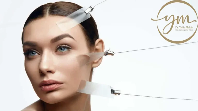 كيف تتجنبين مظهر الوجه المشدود بشكل غير طبيعي بعد الجراحة؟ - د. يحيي مكين
